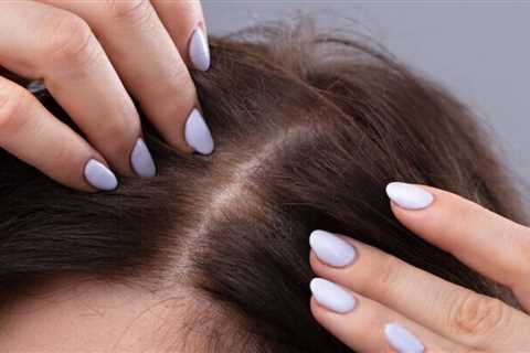 8 Causes that May Be At the Root of Your Hair Loss