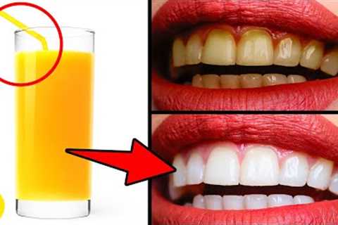 Get Rid Of Your Yellow Teeth Fast With These 7 Easy Ways