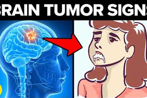 7 Early Warning Signs Of A Brain Tumor You Need To Know About