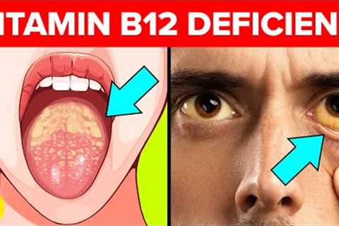 9 Warning Signs That Your Body Is Low On Vitamin B12