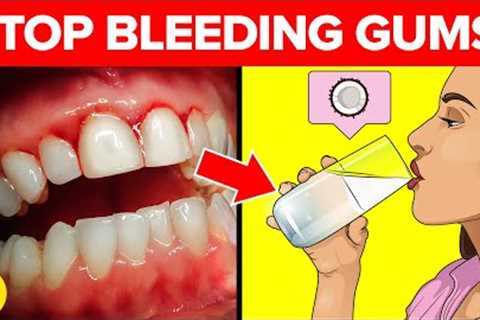 16 Great Techniques for Stopping Your Bleeding Gums