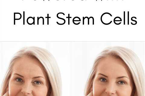 Why Is Plant Stem Cells Good For Your Skin?
