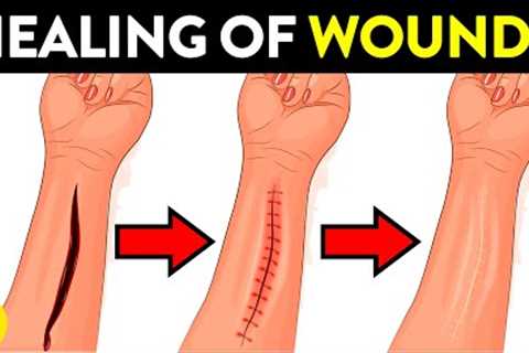 How Does Your Body Heal Cuts & Wounds?