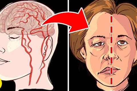 What Happens To Your Body When You Get A Stroke