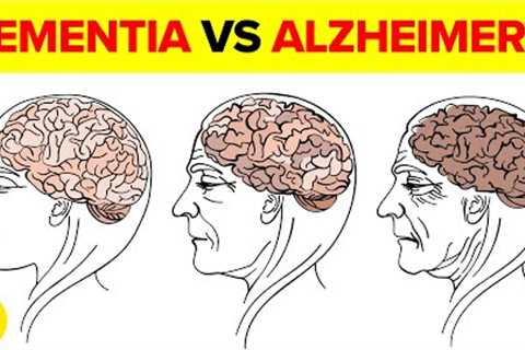 Dementia Vs Alzheimer's: How to Tell the Difference