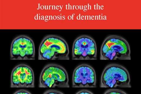 World Alzheimer’s Month—Diagnosis of Dementia