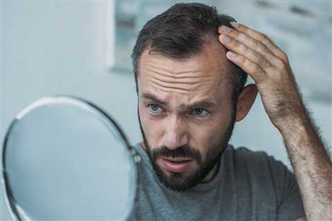 Eating Less of This Could Reduce Your Hair Loss, New Study Finds