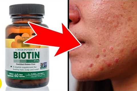 7 Serious Side Effects Of Biotin