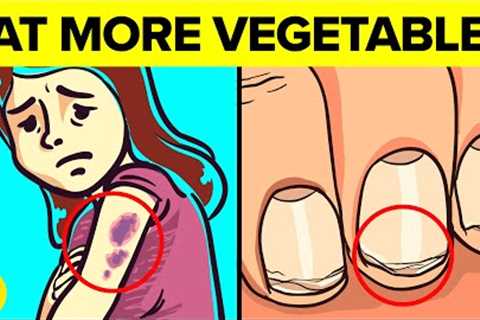 17 Signs You’re Not Eating Enough Vegetables