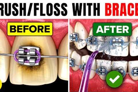How To Brush Your Teeth & Floss With Braces