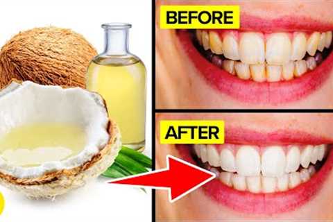 Here’s How You Get Sparkling Teeth In Under 20 Minutes!