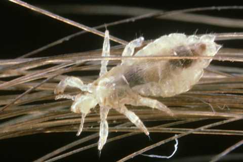 Covid Head-Scratcher - Why Lice Lurk Despite Physical Distancing