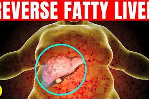 5 Ways To Reverse Fatty Liver