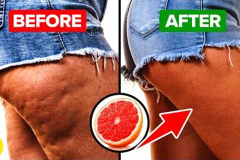7 Foods That Kill Cellulite And 7 That Make It Worse