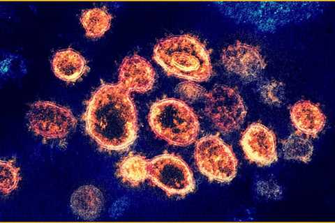 Coronavirus Chronicles -- Obesity and Long COVID - A Mystery