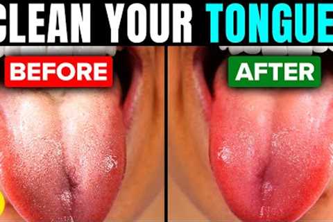 Your Tongue Is Probably Filthy, Here's How To Effectively Clean It