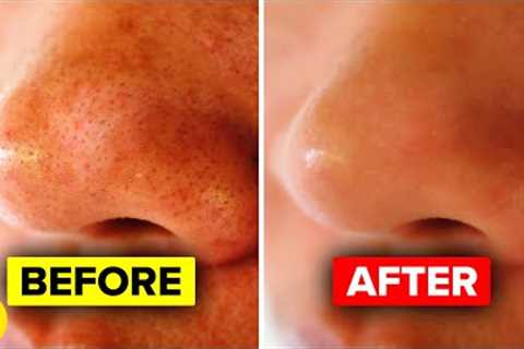 11 Ways To Tighten Large Pores Suggested By Dermatologists