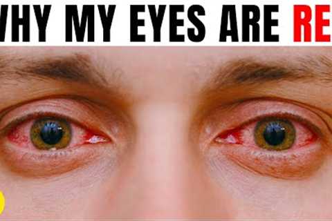 13 Reasons Why Your Eyes Are Always Red