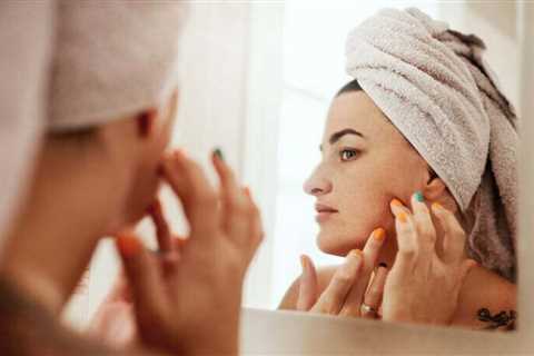 Pimples Not Clearing Up? You Might Be Dealing With Fungal Acne