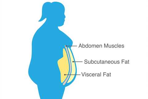 I'm a Doctor and Here's the #1 Sign You Have Visceral Fat